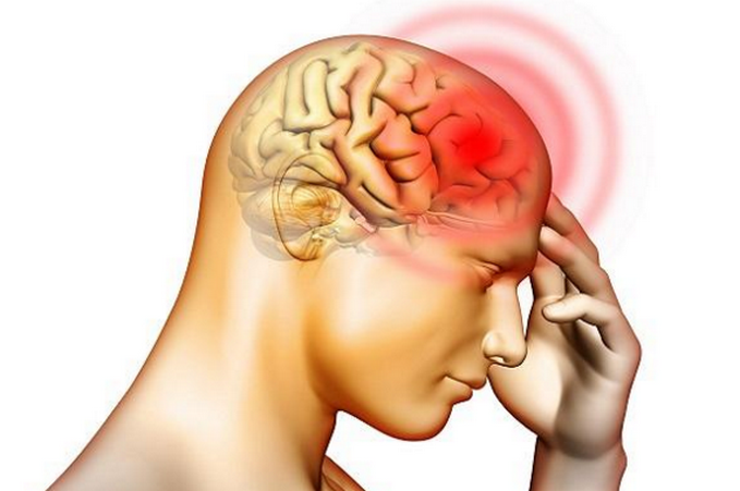 Нехватка всего 4 продуктов провоцирует головную боль