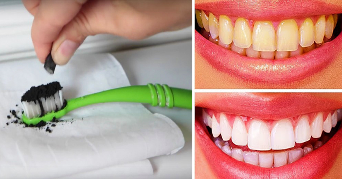 Отбеливание зубов активированным углем в домашних японская зубная щетка